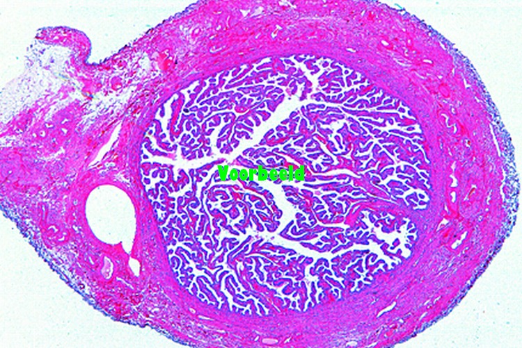 Oviduct (fallopian tube), t.s. in region