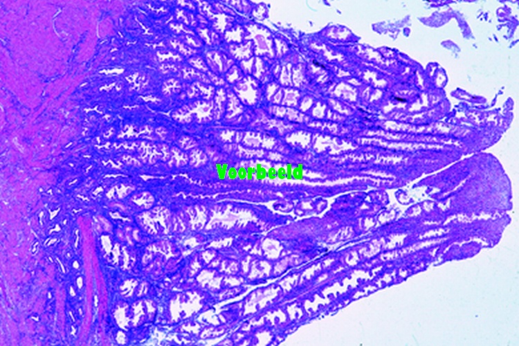 Uterus, human, proliferative stage t.s.