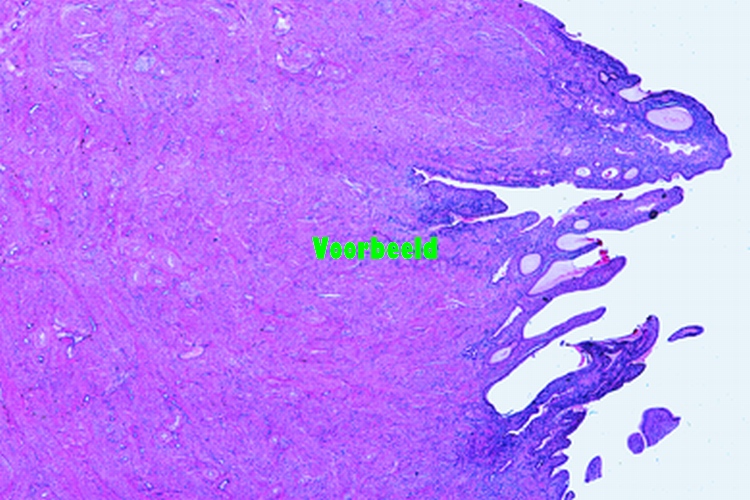 Uterus, human, pregnant (gravid), t.s.