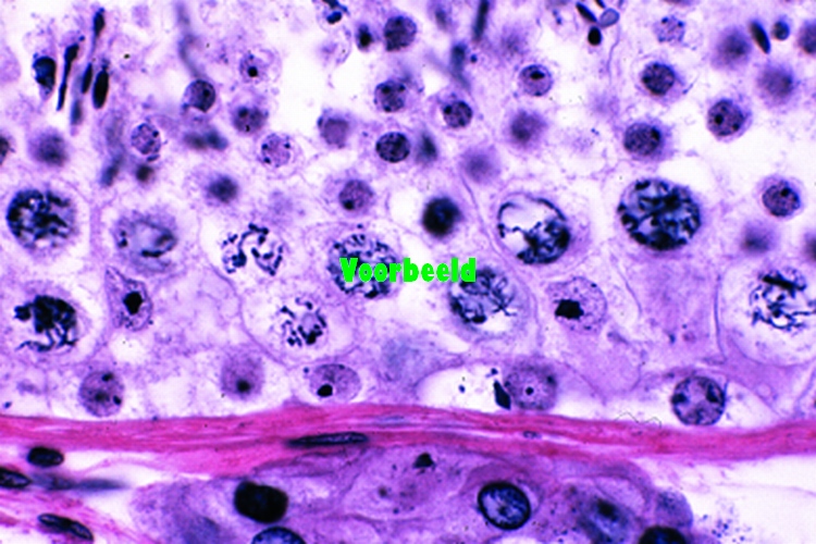 Preparaat testis c.s.
