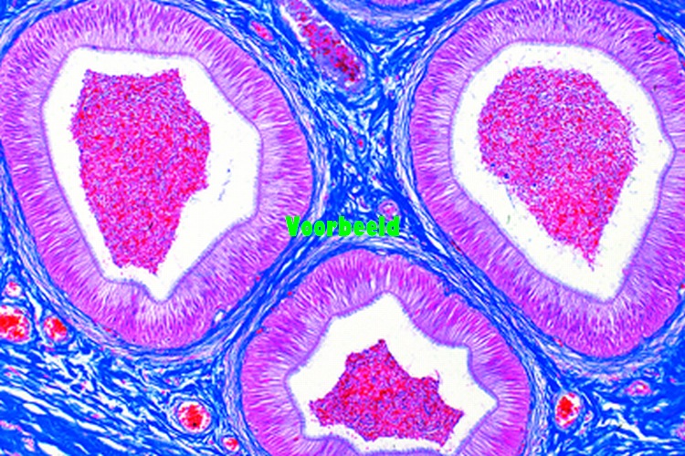Epididymis, human t.s.