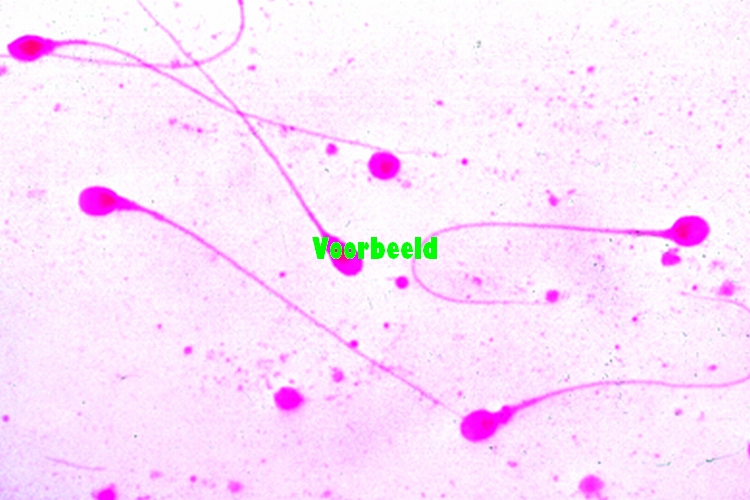Sperm smear, human