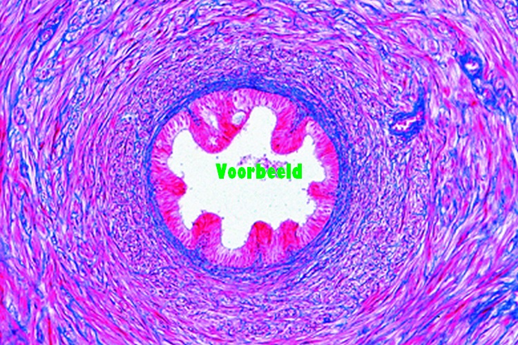 Spermatic cord (Ductus deferens), human