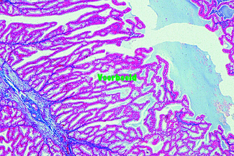 Seminal vesicle (Gl. vesiculosa), human