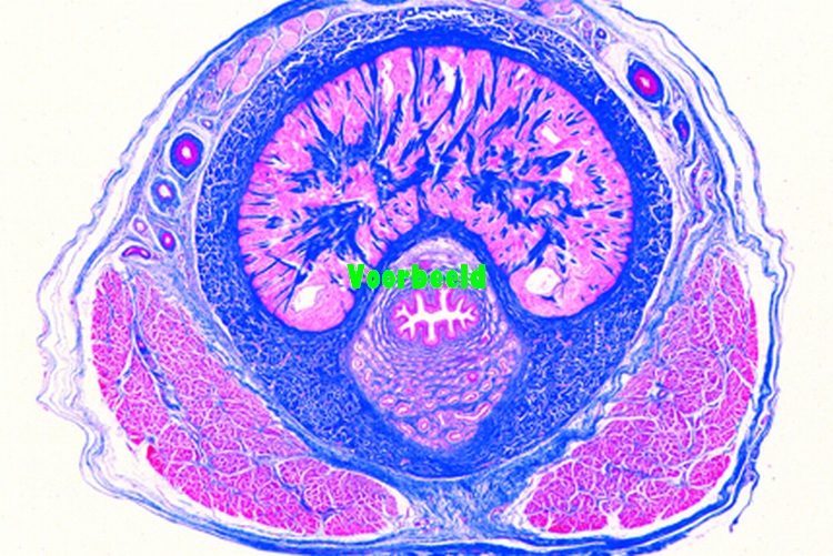 Penis from human foetus, t.s.