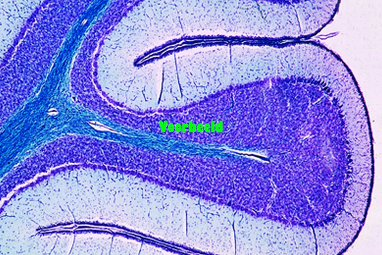 Cerebellum from human foetus, t.s. routi