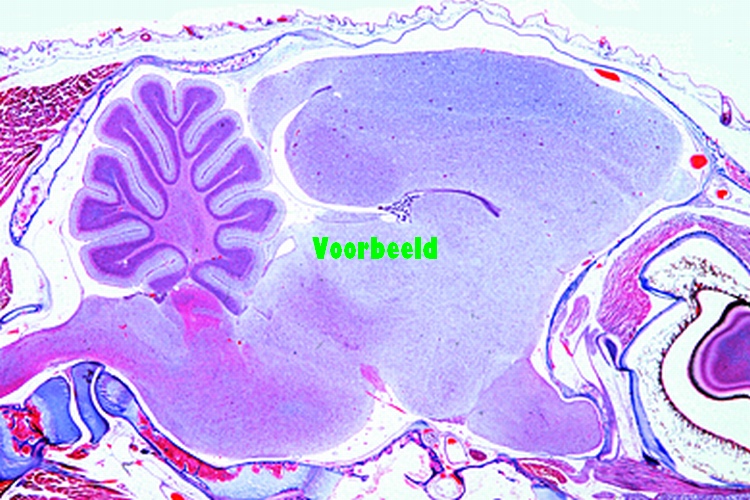 Cerebrum and cerebellum composite slide,