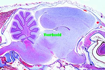Cerebrum and cerebellum composite slide,