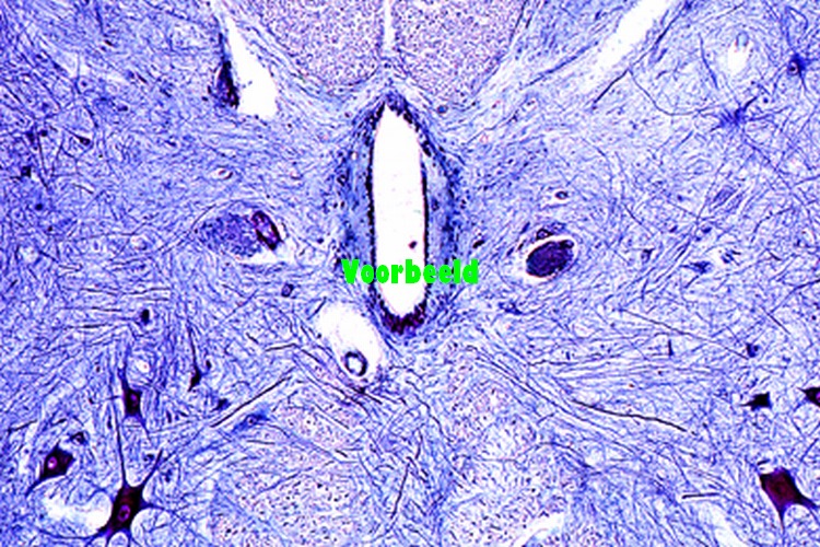Spinal cord, human l.s. routine stained