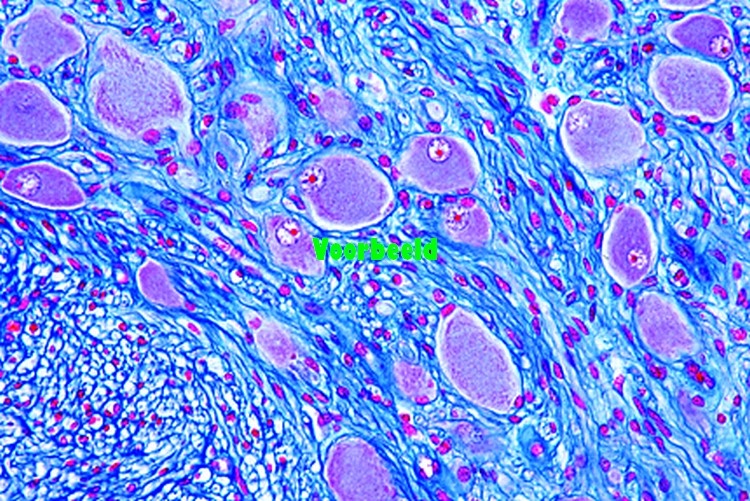 Spinal ganglion, human t.s.