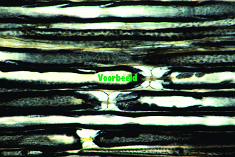 Peripheral nerve, human l.s.