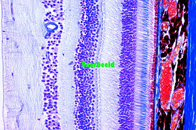 Retina from eye, t.s.