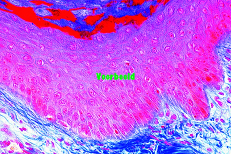 Body skin, white, vertical l.s.