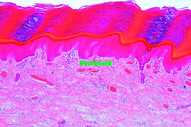 Skin from palm, human, vertical l.s.