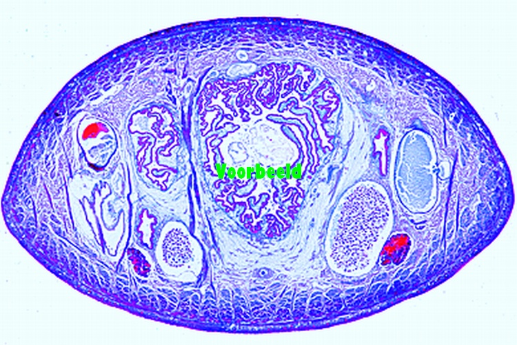 Hirudo medicinalis