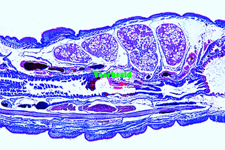 Lumbricus