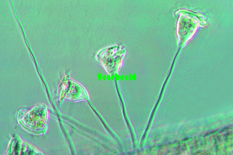 Vorticella