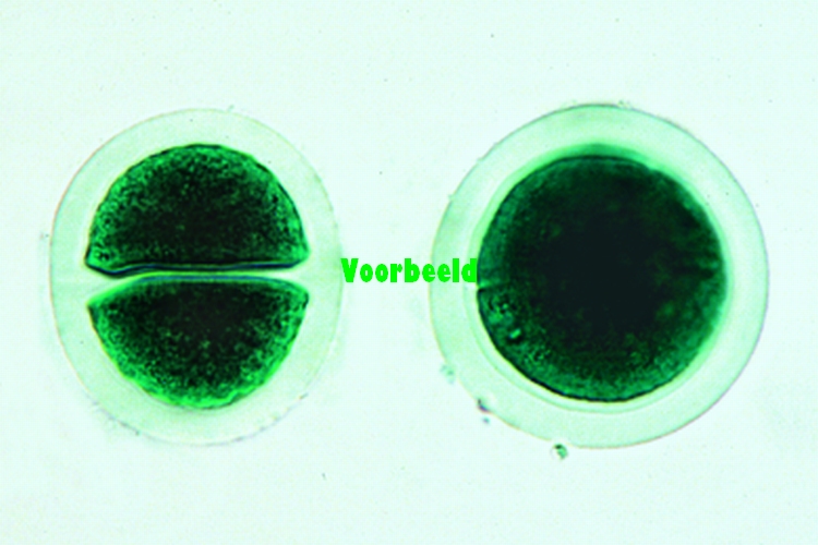 Bacteriën en Lagere Planten