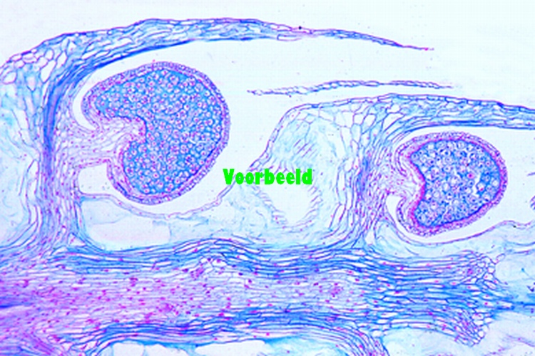 Lycopodium