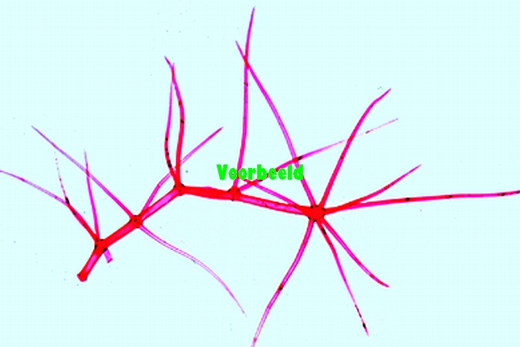 Branched leaf hairs, isolated and w.m. f