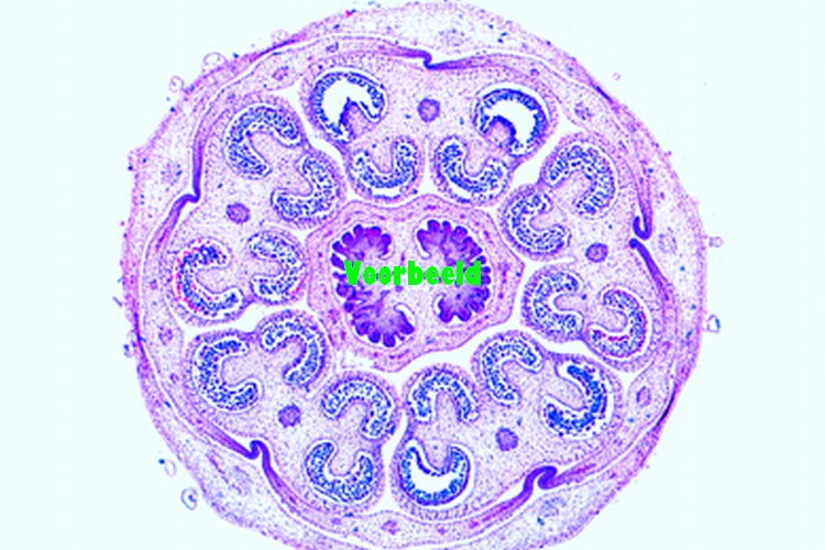 Solanum tuberosum