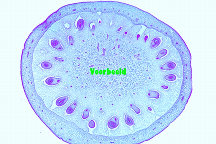 Lycopersicum