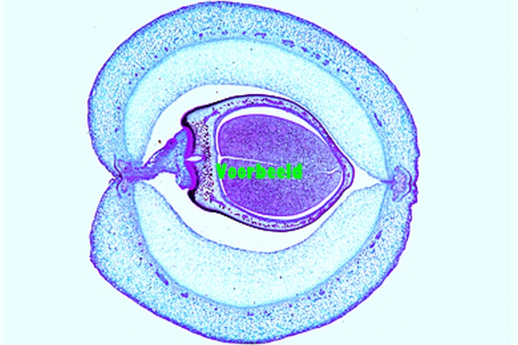 Phaseolus