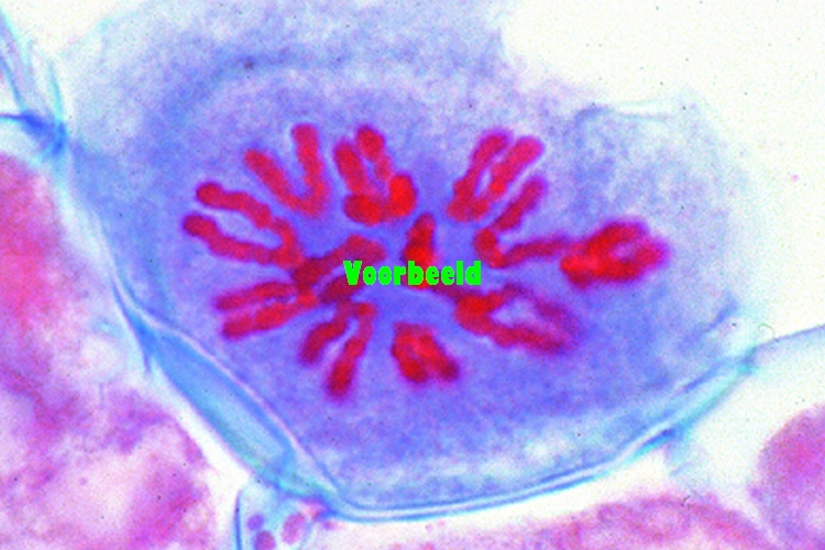 Mitosis, t.s. from Allium root tips show