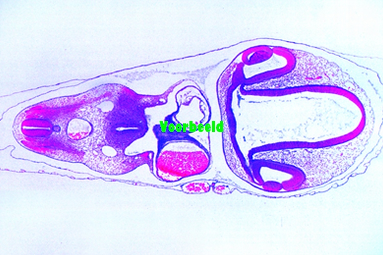 Embryo kip