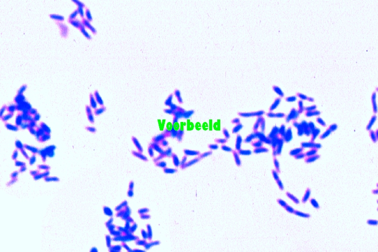Corynebacterium diphteriae