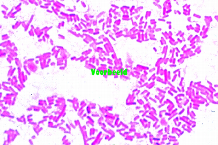 Shigella dysenteriae