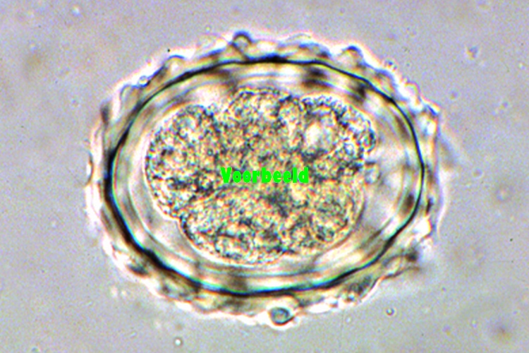 Ascaris lumbricoides