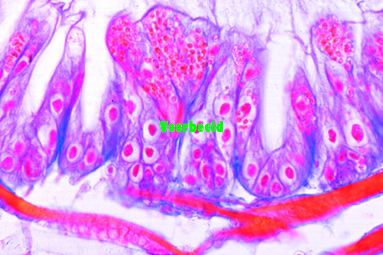Nosema apis