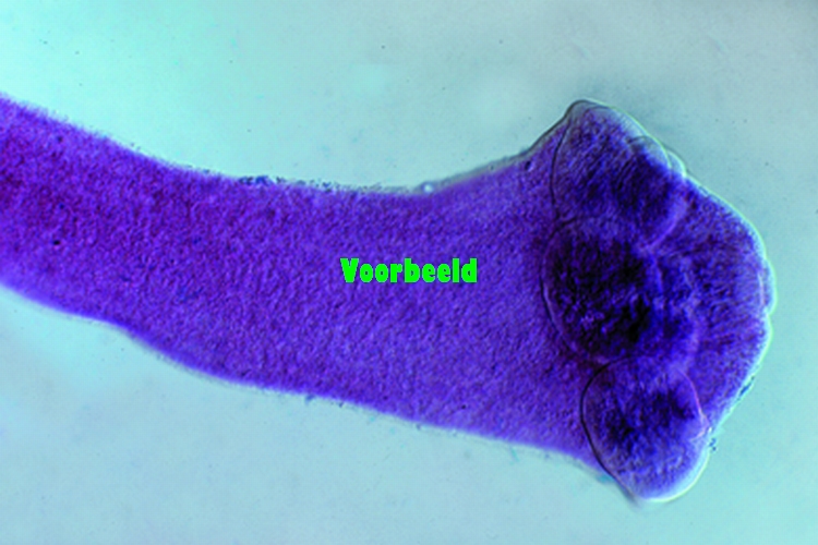 Dipylidium caninum
