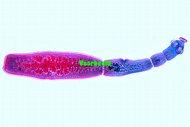Echinococcus granulosus