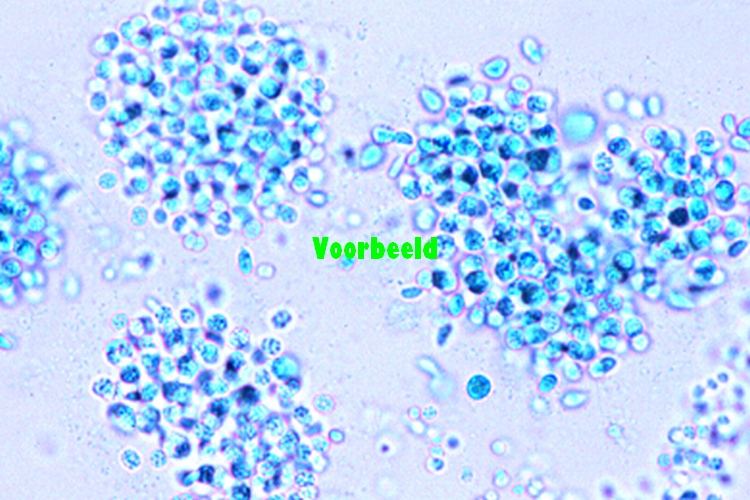 Microcystis
