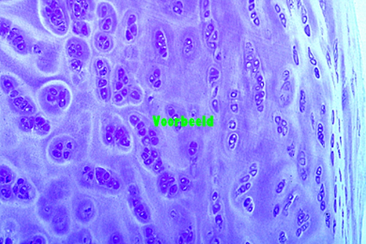 Hyaline cartilage, human t.s.