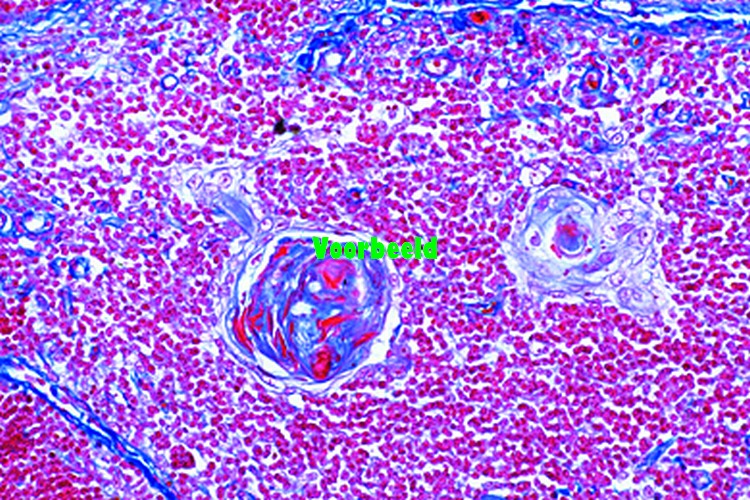 Thymus gland from human child t.s.