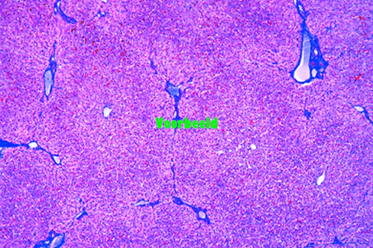 Liver, human t.s.