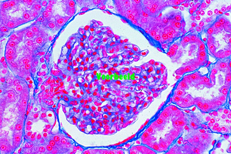 Kidney, human t.s.