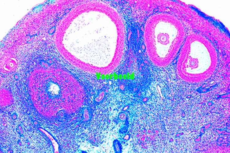 Ovary, human t.s.