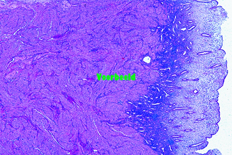 Uterus, human t.s.