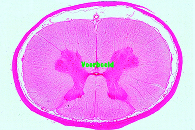 Spinal cord, human t.s.