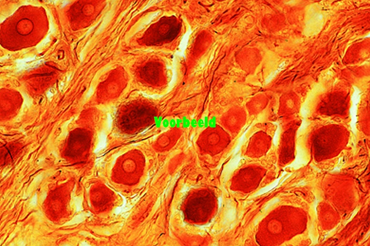 Sympathetic ganglion, human t.s.