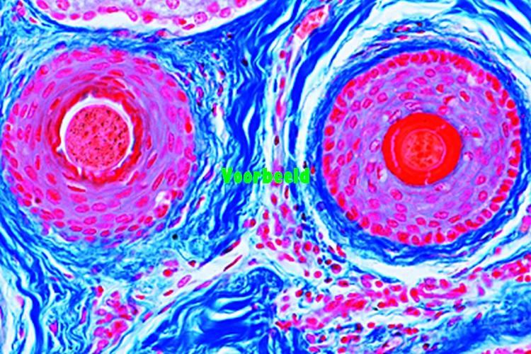 Scalp, human, t.s. of hair follicles