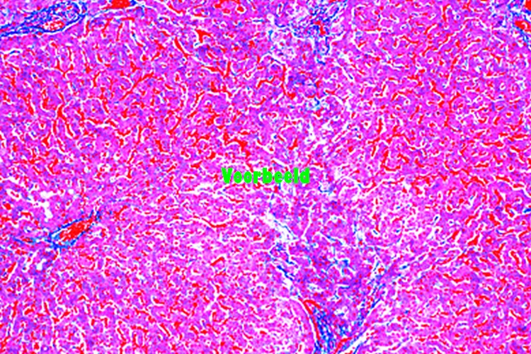 Menselijke pathologie basis set, individueel